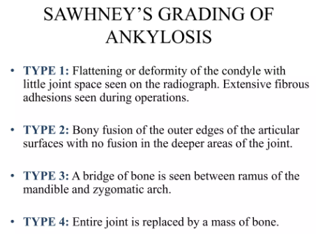 Classification of ankylosis